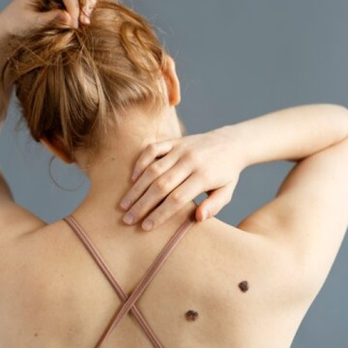 jovem-mulher-com-toupeiras-de-tiro-medio_23-2149359608