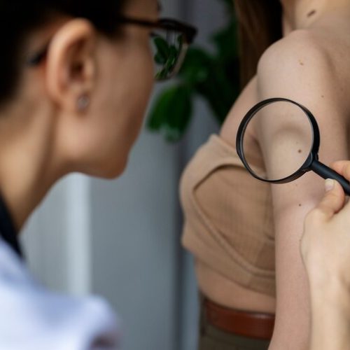 medica-diagnosticando-um-melanoma-no-corpo-de-uma-paciente-do-sexo-feminino_23-2149365765